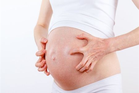 孕妇为什么会得湿疹?孕期湿疹影响胎儿吗图片